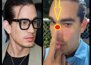 LO QUE LE HICIERON A GIUSSEPE